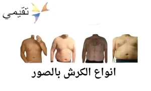 أنواع الكرش بالصور